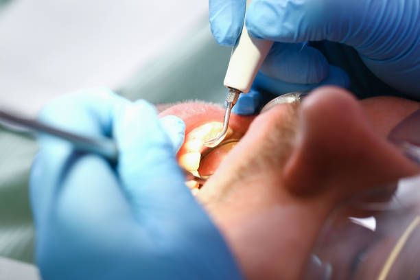Best Broken Tooth Emergency  in Gibsonville, NC
